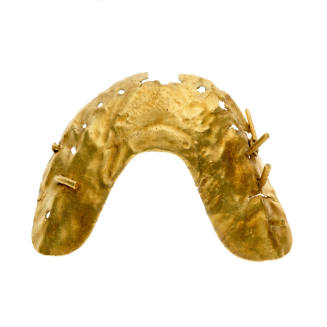 Gold denture: upper jaw: recovered from the wreck of the DUNBAR